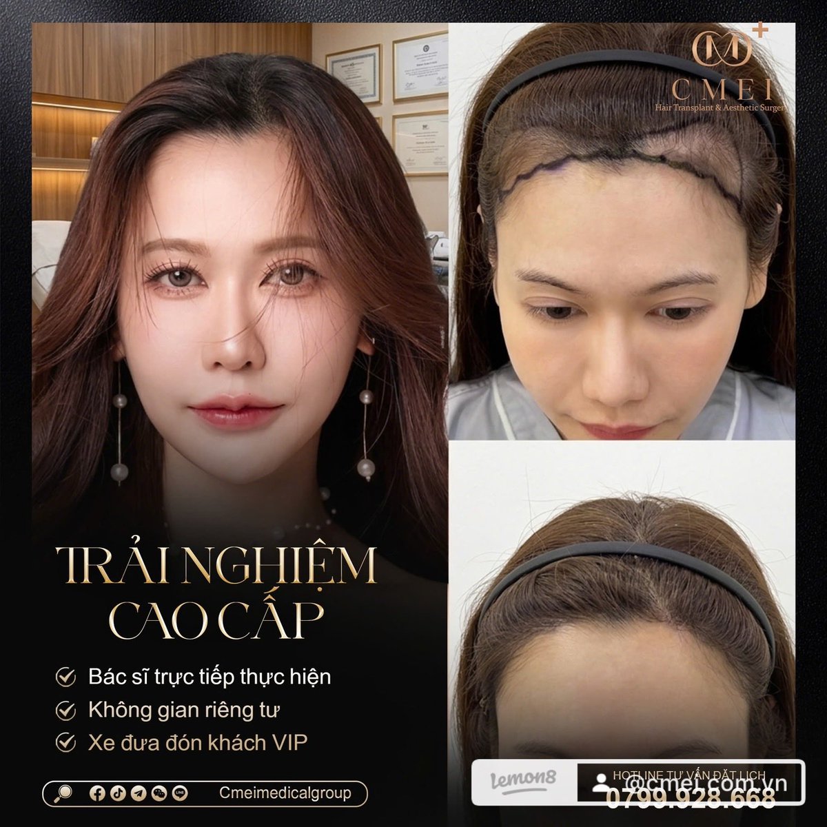 cmeimedical's tweet photo. 🏥 CMEI – 5-STAR INTERNATIONAL AESTHETIC CLINIC COMING SOON TO SAIGON

🔥 GRAND OPENING LIMITED OFFER 🔥
💥 HAIR TRANSPLANT ONLY 45 MILLION VND (FULL PACKAGE)

✔️ Latest advanced technology applied
✔️ Performed directly by doctors &amp; international experts
ho chi Minh City https://t.co/82UA5QnkKp