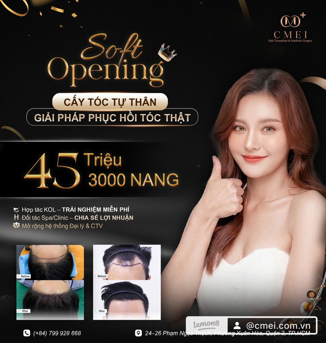 cmeimedical's tweet photo. 🏥 CMEI – 5-STAR INTERNATIONAL AESTHETIC CLINIC COMING SOON TO SAIGON

🔥 GRAND OPENING LIMITED OFFER 🔥
💥 HAIR TRANSPLANT ONLY 45 MILLION VND (FULL PACKAGE)

✔️ Latest advanced technology applied
✔️ Performed directly by doctors &amp; international experts
ho chi Minh City https://t.co/82UA5QnkKp