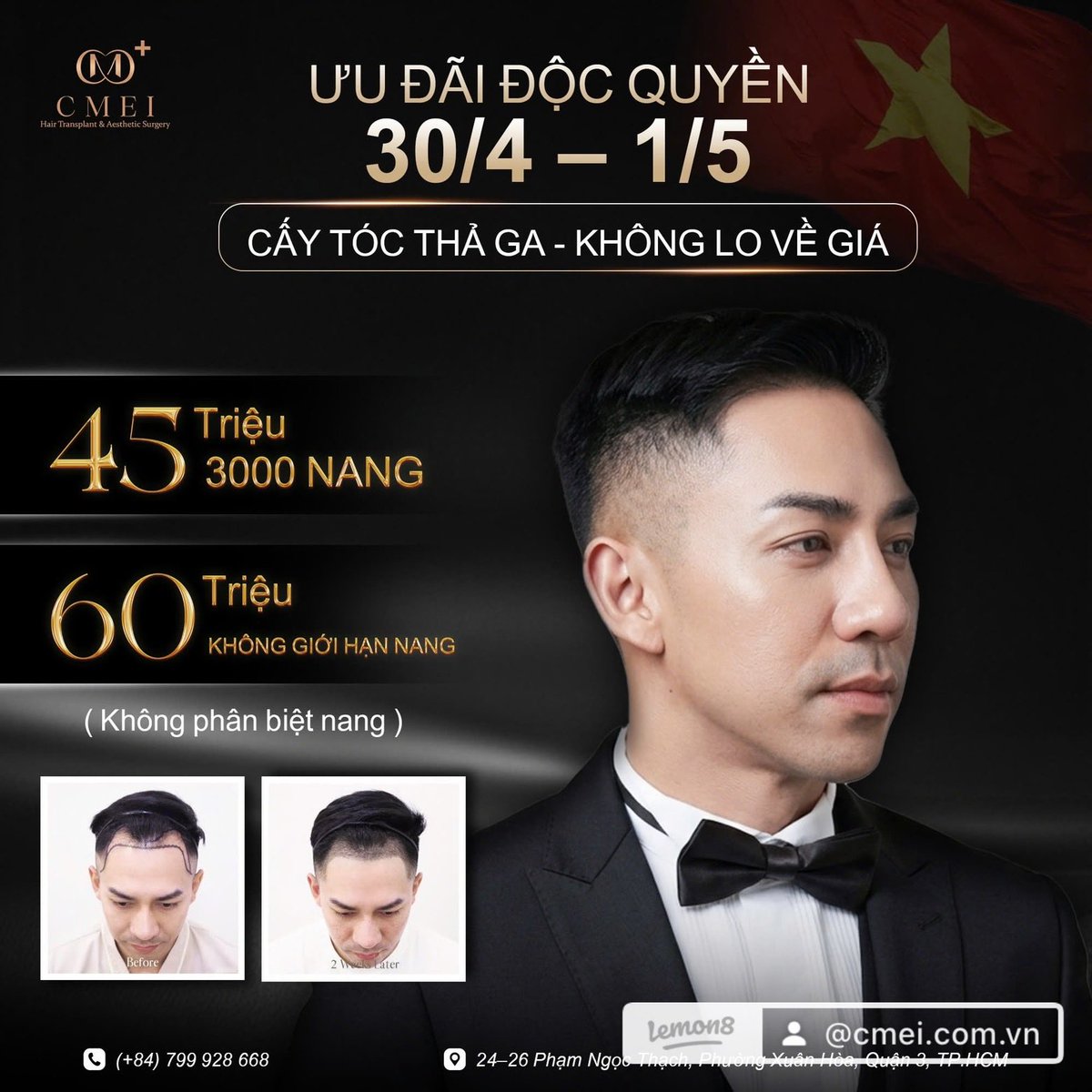 cmeimedical's tweet photo. 🏥 CMEI – 5-STAR INTERNATIONAL AESTHETIC CLINIC COMING SOON TO SAIGON

🔥 GRAND OPENING LIMITED OFFER 🔥
💥 HAIR TRANSPLANT ONLY 45 MILLION VND (FULL PACKAGE)

✔️ Latest advanced technology applied
✔️ Performed directly by doctors &amp; international experts
ho chi Minh City https://t.co/82UA5QnkKp