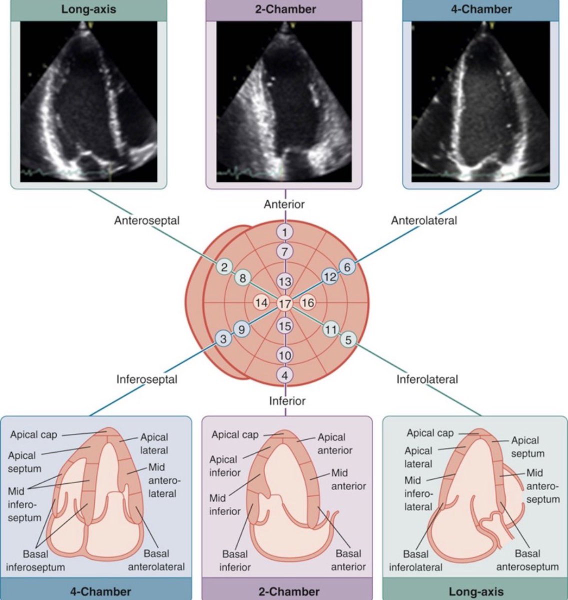 ZainKhalpey's tweet image. Echo is all about perspective. 

Different views come together to build the full picture of the heart. 

@TrackYourHeart 

#MedTwitter #Cardiology #Echocardiography #MedEd