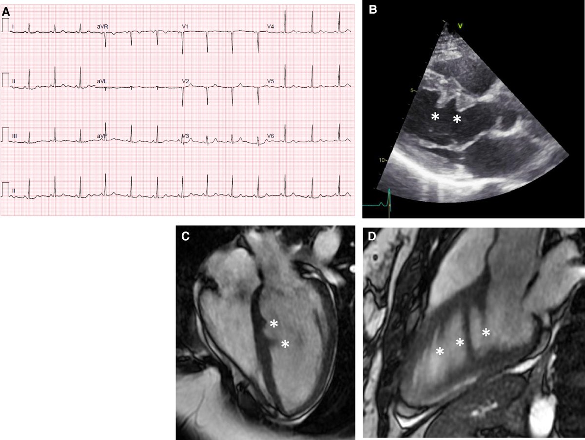 European Society of Cardiology Journals tweet media