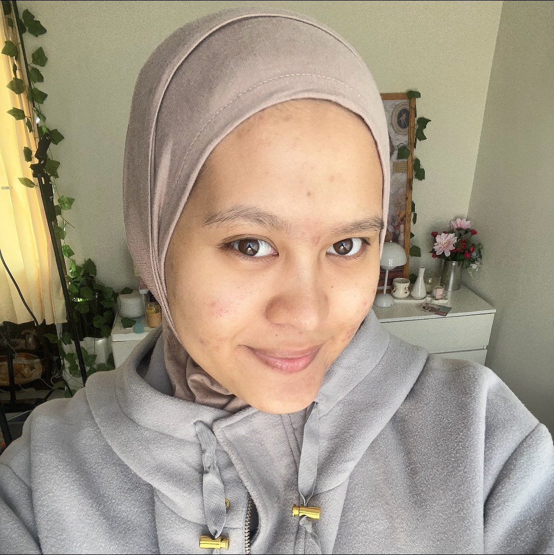 cipa 🐰 tweet media