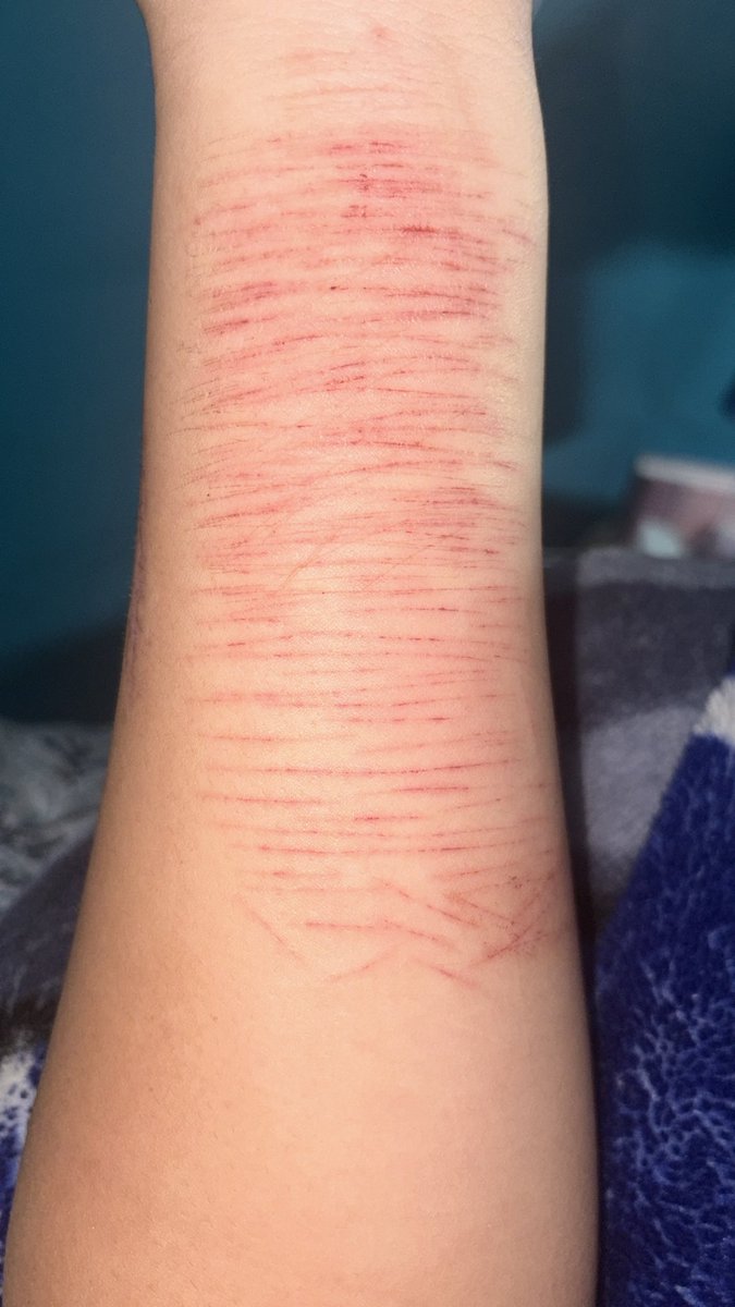 x.D34d._.4Ng3L.x tweet media