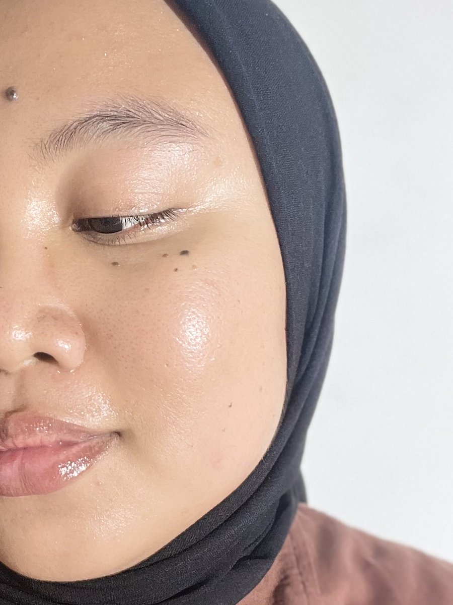 Real ternyata lifestyle matters ya. Jujur kulit jd lebih kalem dan ga gampang rewel semenjak nerapin ga begadang, rajin minum air putih, less stress, dan skinacarean cukup basic aja. Kulit lebih kenyal, sehat, dan ga gampang kusem. Poin penting lainnya.. KONSISTEN!