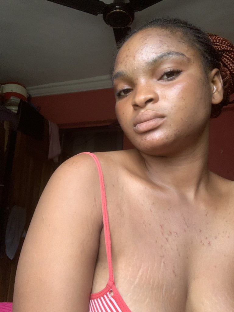 Enori🎀 tweet media