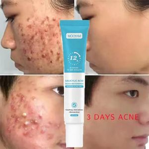 Elage88's tweet photo. Gel Mooyam Anti acné, très efficace pour éliminer les boutons, les points noirs, taches bref toutes imperfections... 3 jours après tu vas voir des résultats positifs
NB : Vous pouvez consulter Google ou autre méthode de recherche pour voir la fiabilité du produit 
+221779552383 https://t.co/4VgvKylAr2