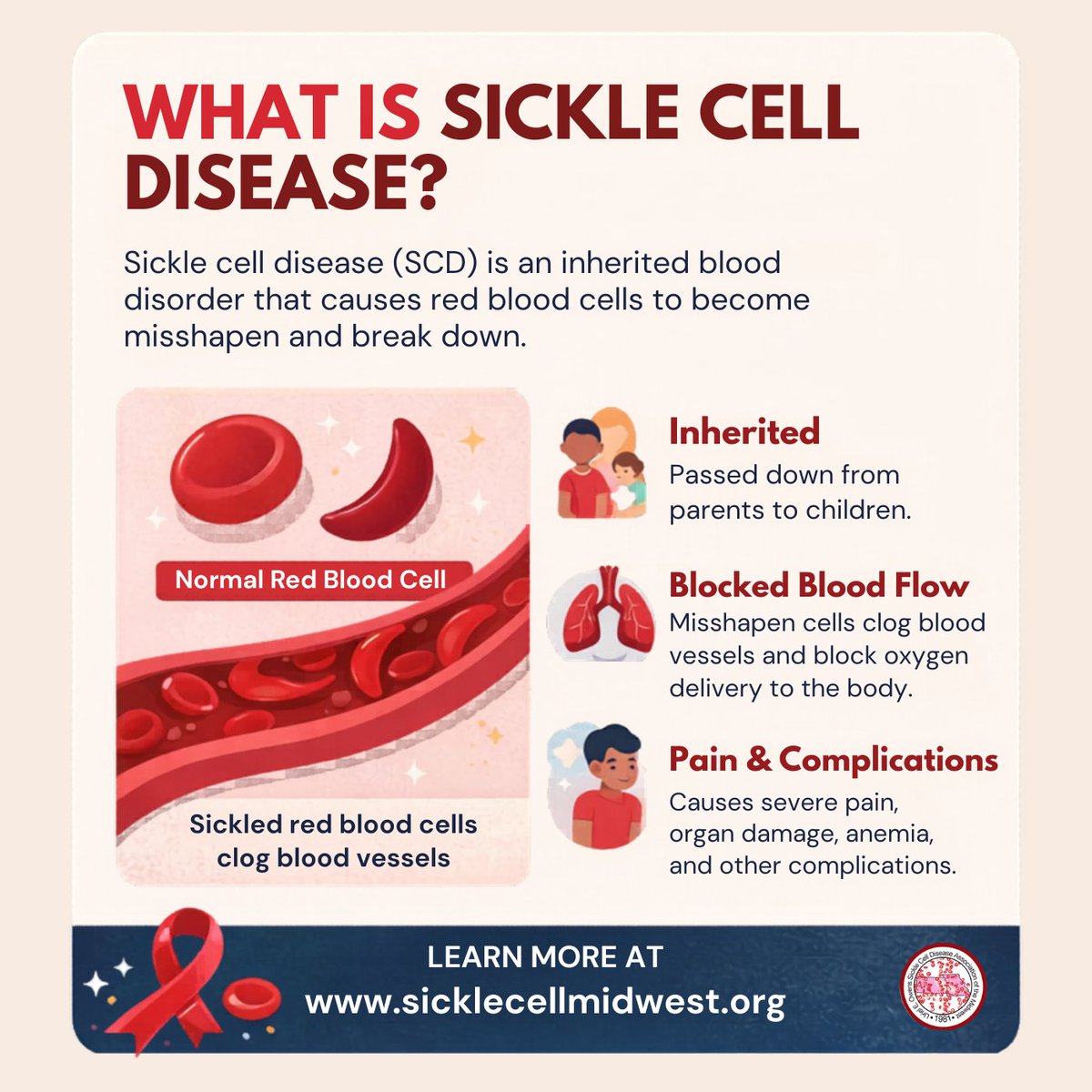UEO Sickle Cell tweet media