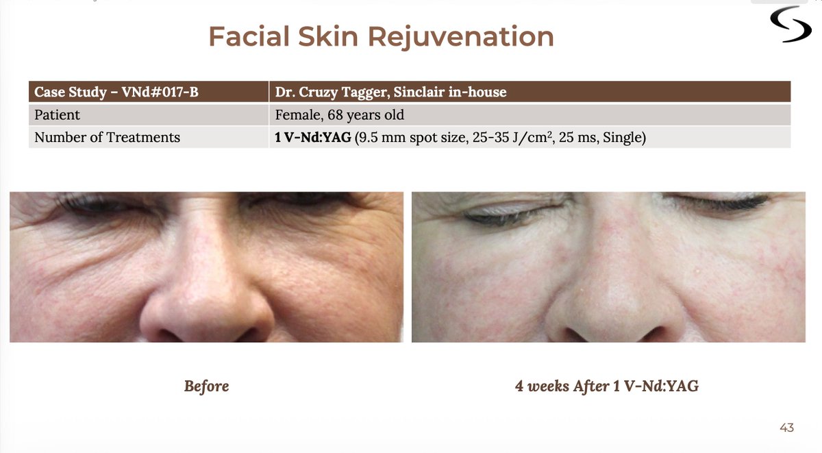 MagnifiqueLaser's tweet photo. We personalize every laser and RF treatment for your skin — clinician-led assessments set energy and timing so you see results with minimal downtime! Book at our Rockville Centre clinic for medically supervised care you can trust: https://t.co/tg5lER95dj #SkinCare https://t.co/enMoGjejm1