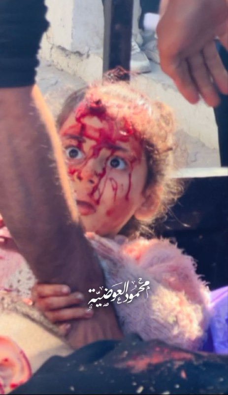 Motasem A Dalloul tweet media