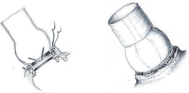 Heart, Vessels and Transplantation tweet media