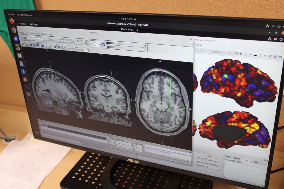 TulaneSSE's tweet photo. Ian Faul is proof that your "diverse trajectory" is actually your superpower. The Tulane senior is charting a path to medicine by connecting brain imaging research, science journalism, and the arts.

Read more about his story: https://t.co/bCJwJFsx2H https://t.co/2UsvUDiqwJ