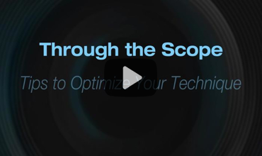 gastroendonews's tweet image. New Through the Scope video 🎥
Rajesh Keswani walks through resection of a rectal carcinoid and explains why some lesions require more than conventional EMR. gastroendonews.com/a/AzgBAA/t #Endoscopy #Gastroenterology