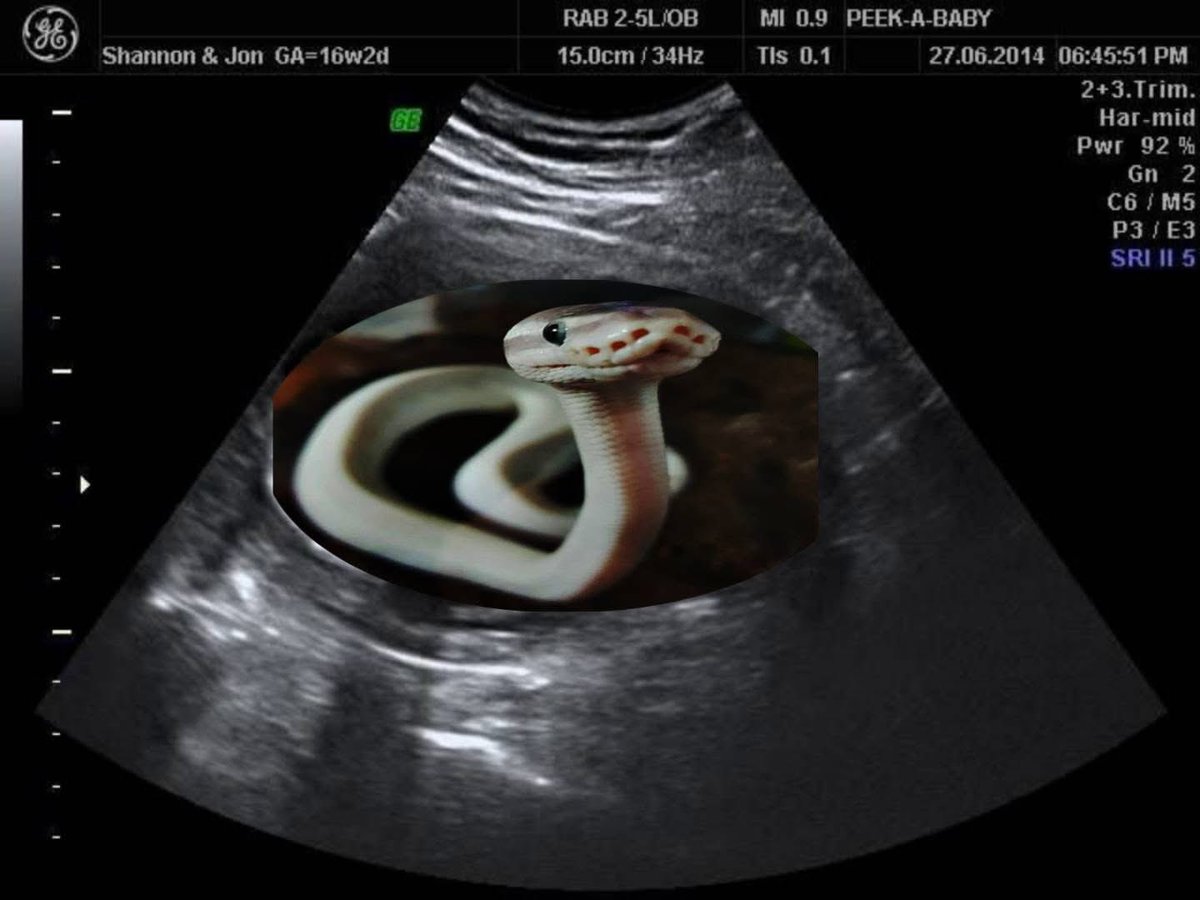 kgadi♠️ tweet media