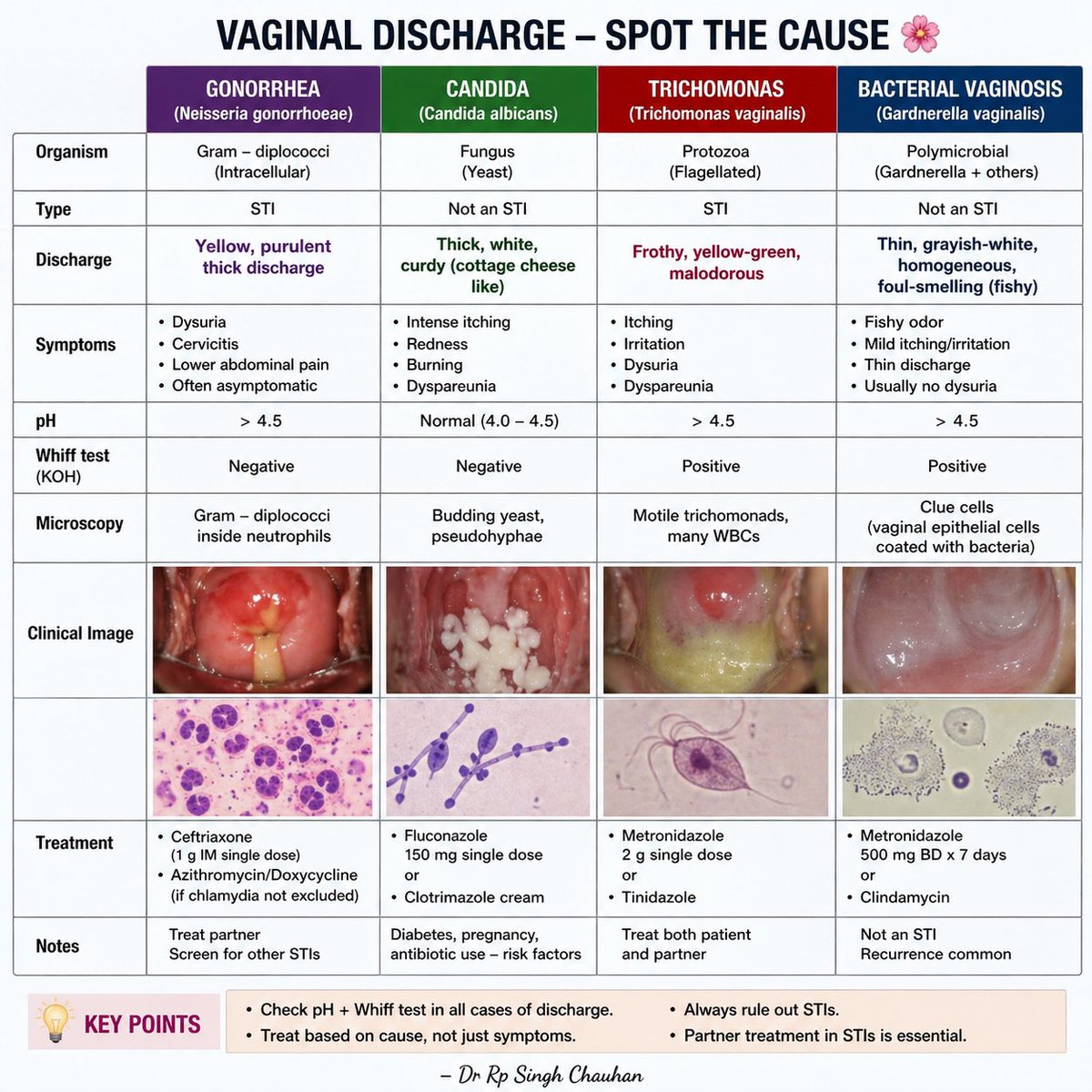 rpsingh1894's tweet image. Not all vaginal discharge is infection…
But missing the diagnosis can cost you. 👀

Can you differentiate Candida vs BV vs Trichomonas vs Gonorrhea in seconds?

👇 This chart will make it EASY

#DiagnosisMatters #DontMissThis #PatientCare #PrimaryCare #EmergencyMedicine