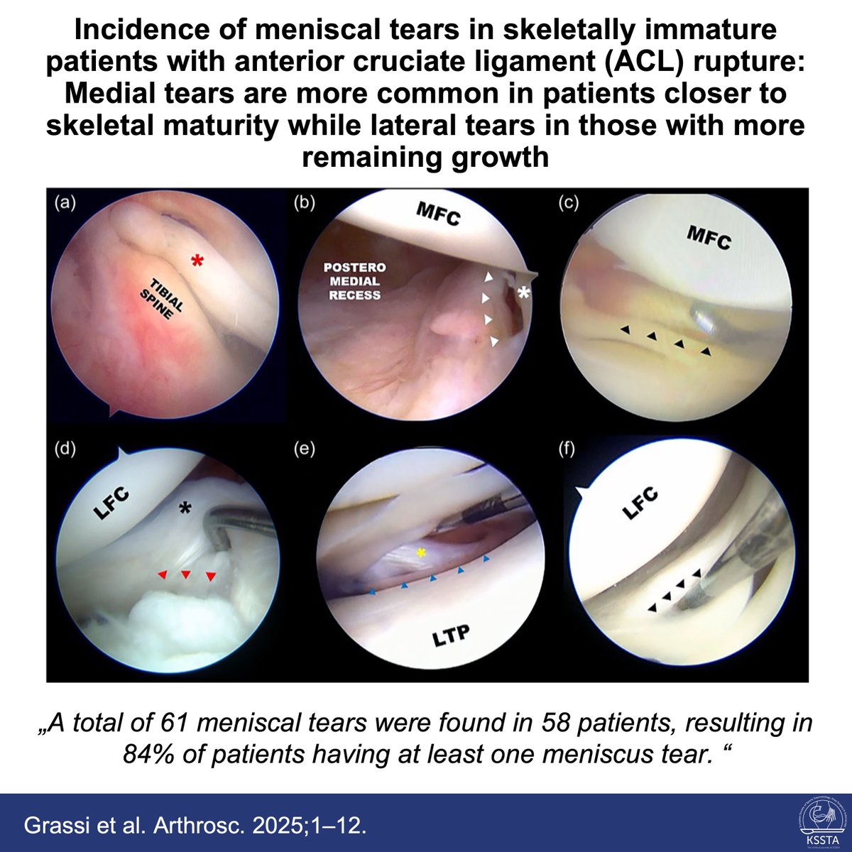 Knee Surgery, Sports Traumatology, Arthroscopy tweet media