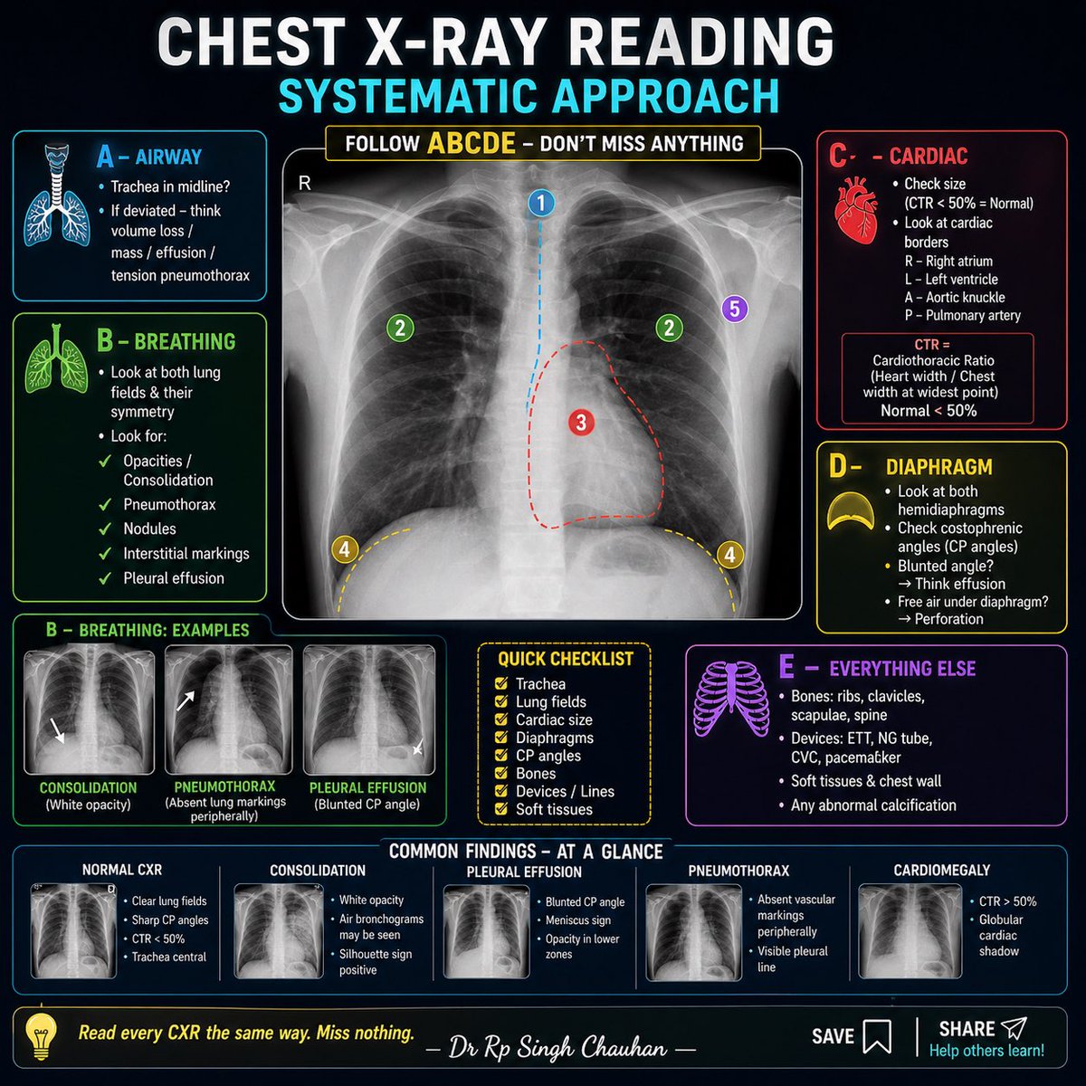 rpsingh1894's tweet photo. Every chest X-ray tells a story.
If you follow a system—you’ll never miss it.
ABCDE approach explained 👇
#ChestXray #CXR #Radiology #MedicalEducation #MedTwitter
#ClinicalPearls #ABCDE #EmergencyMedicine #DoctorsOfX #MedEd https://t.co/8kAQxJGEbY