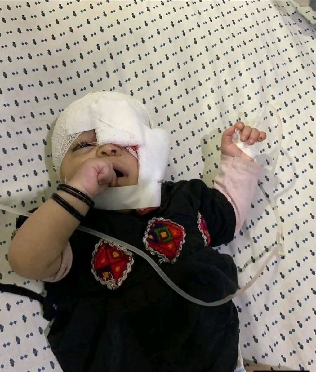 RafiqYousufzai's tweet image. یہ فلسطین نہیں پختونخوا ہے
باڑہ اکاخیل میں ظلم کی انتہا لیکن صوبائی حکومت بالخصوص وزیراعلی کو پتہ تک نہیں کیونکہ اس کو کشمیر ، مردان ،پشاور ،صوابی میں بڑے بڑے جلسے کرنے ہیں 
بڑے جلسے کرنے سے صوبے میں دہشتگردی ،بےروزگاری،بدامنی اور غربت ختم ہو جائے گی

رفیق اکبر 
#WeWantPeace