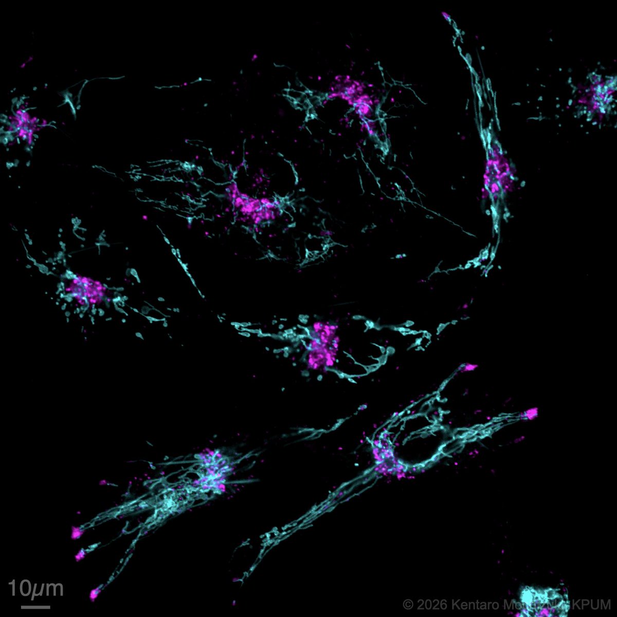 kentmochizuki's tweet image. Live-cell imaging (mitochondria, lipid droplet) | FTC-133*

Mito Tracker Green (Thermo Fisher, M7514): Cyan
Lipi-Red (DOJIND, LD03): Magenta

*human Follicular Thyroid Carcinoma cells

#PositiveControlSharing #Microscopy #Mitochondria #LipidDroplet #ポジコン共有 #顕微鏡