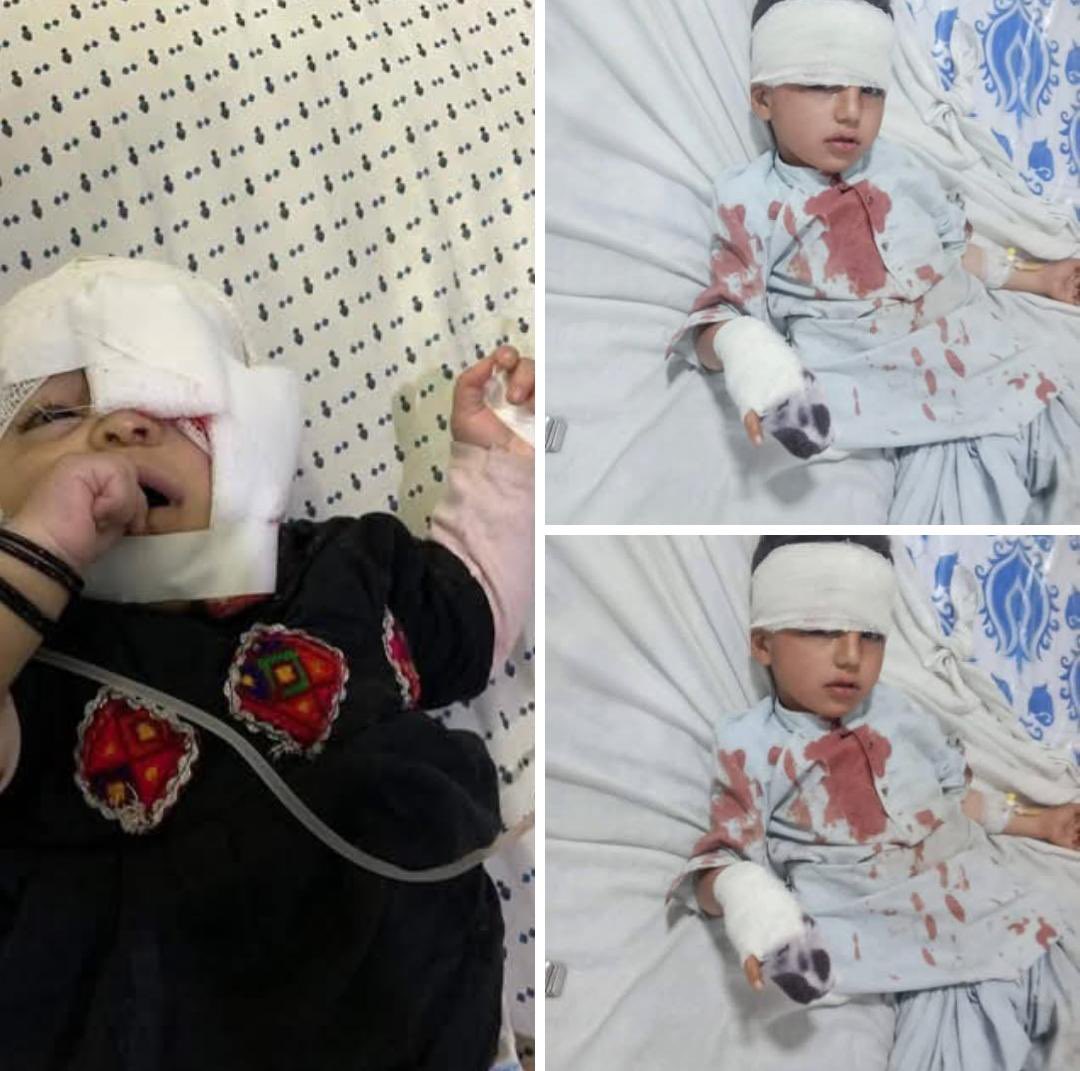 تحصیل باڑہ، قوم اکا خیل (رسول جان مارکیٹ کے قریب) میں ایک گھر پر ہونے والا ڈرون حملہ انتہائی افسوسناک اور لرزہ خیز ہے۔ معصوم خواتین اور بچوں کا اپنے گھروں میں نشانہ بننا ریاست اور اداروں کے لیے بڑا سوال ہے۔

اس حملے میں معصوم بچے اور خواتین شدید زخمی ہوئے۔ گھر کی چار دیواری جہاں