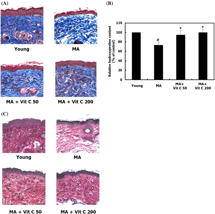 amarelowbr's tweet photo. Inhibitory effect of vitamin C on intrinsic aging in human dermal fibroblasts and hairless mice

https://t.co/j39Lh3P3cK https://t.co/GXdcCALJtp