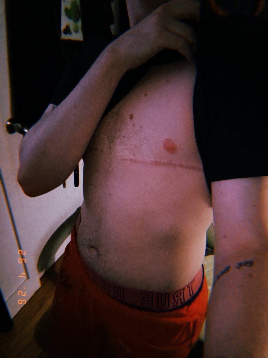 King Mary 🥀 tweet media