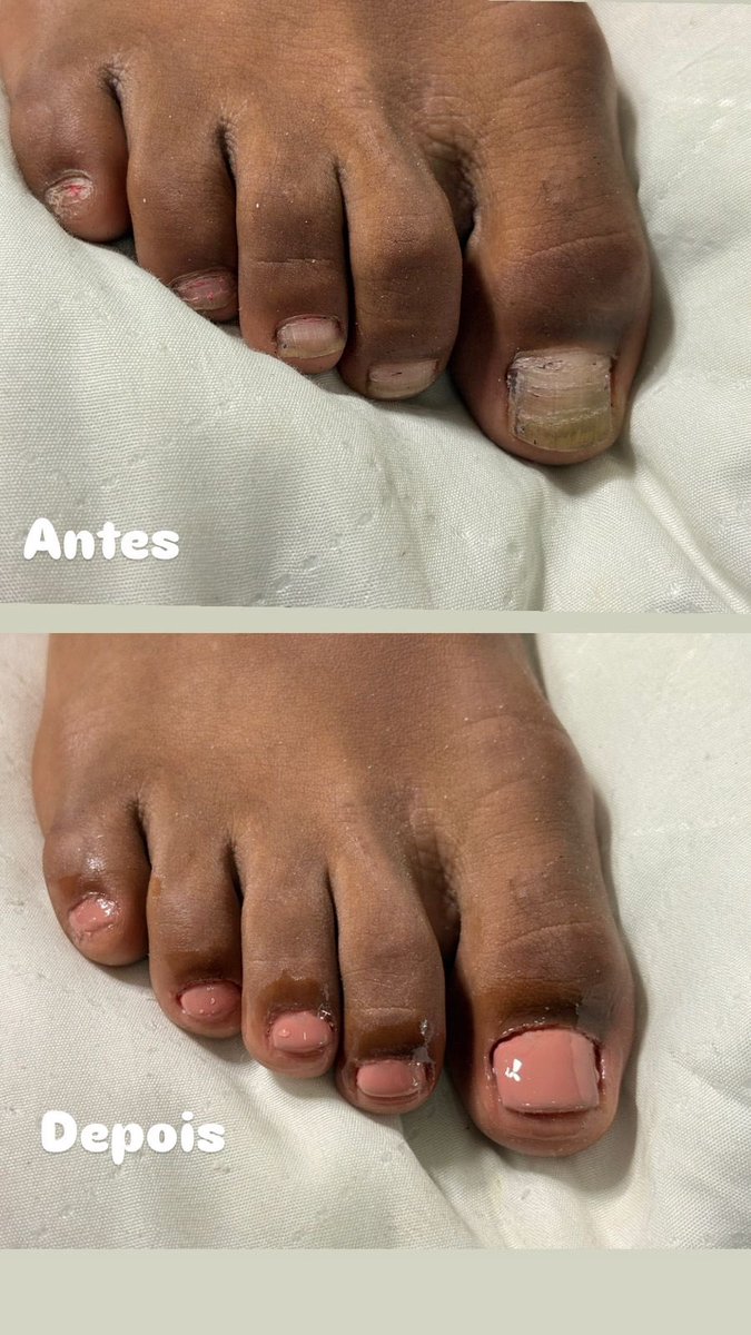 𝖈𝖑𝖆𝖗𝖆𓃭𝖙𝖆𝖗𝖔𝖑𝖔𝖌𝖆 tweet media