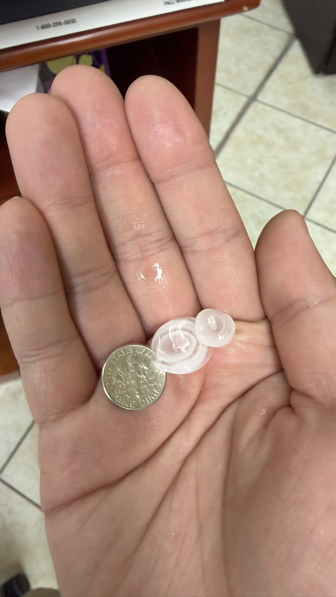 TripleV94's tweet photo. Storm report in CoMo: started off calm with the ominous sights of mammatus clouds and ended up with some pea or dime-sized hail! ⛈️🌫️
@KOMUnews @KOMUMatt @kesley_wx @BethFinelloWx https://t.co/HIzLQO2yjK