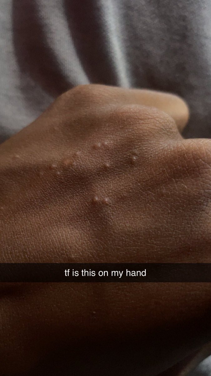 Ehis🦇🦇 tweet media