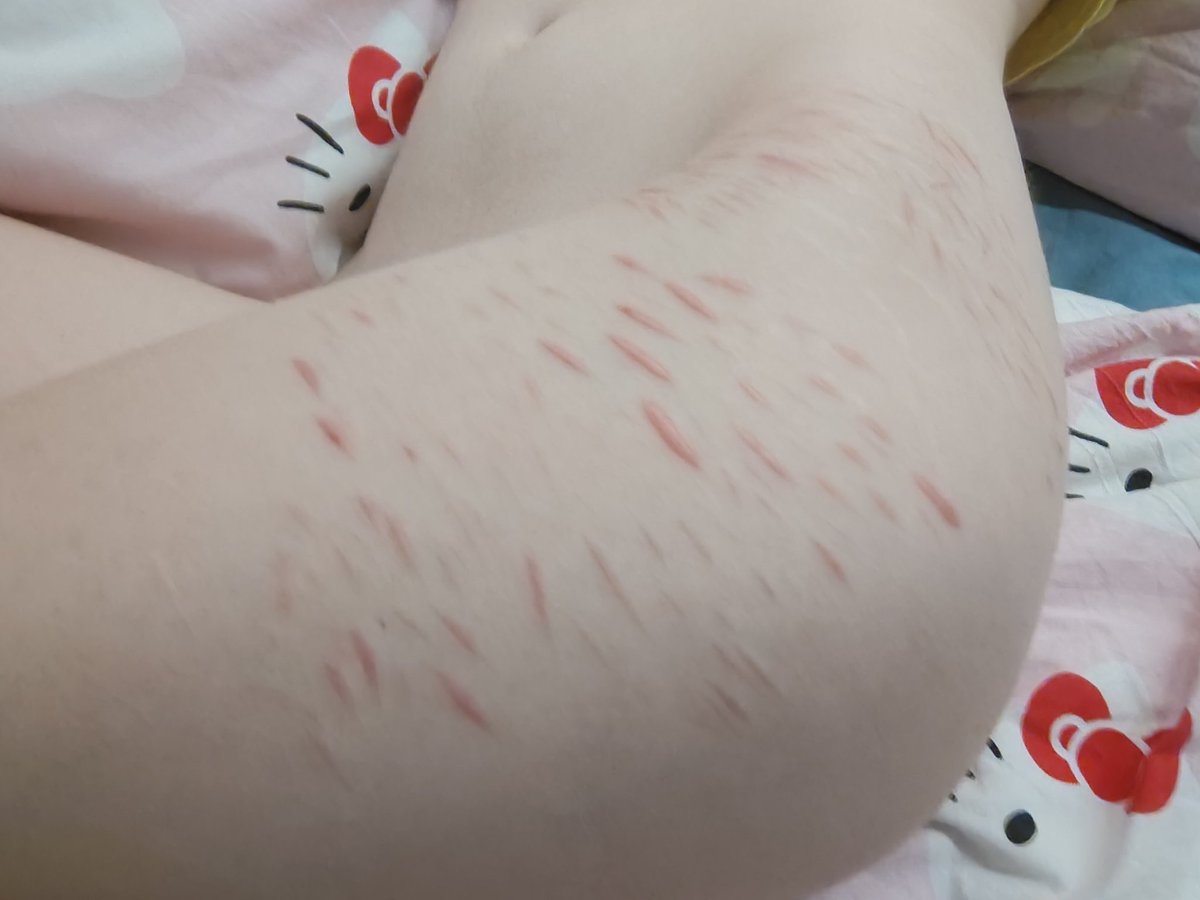 zoey 𐙚 shedtwt tweet media