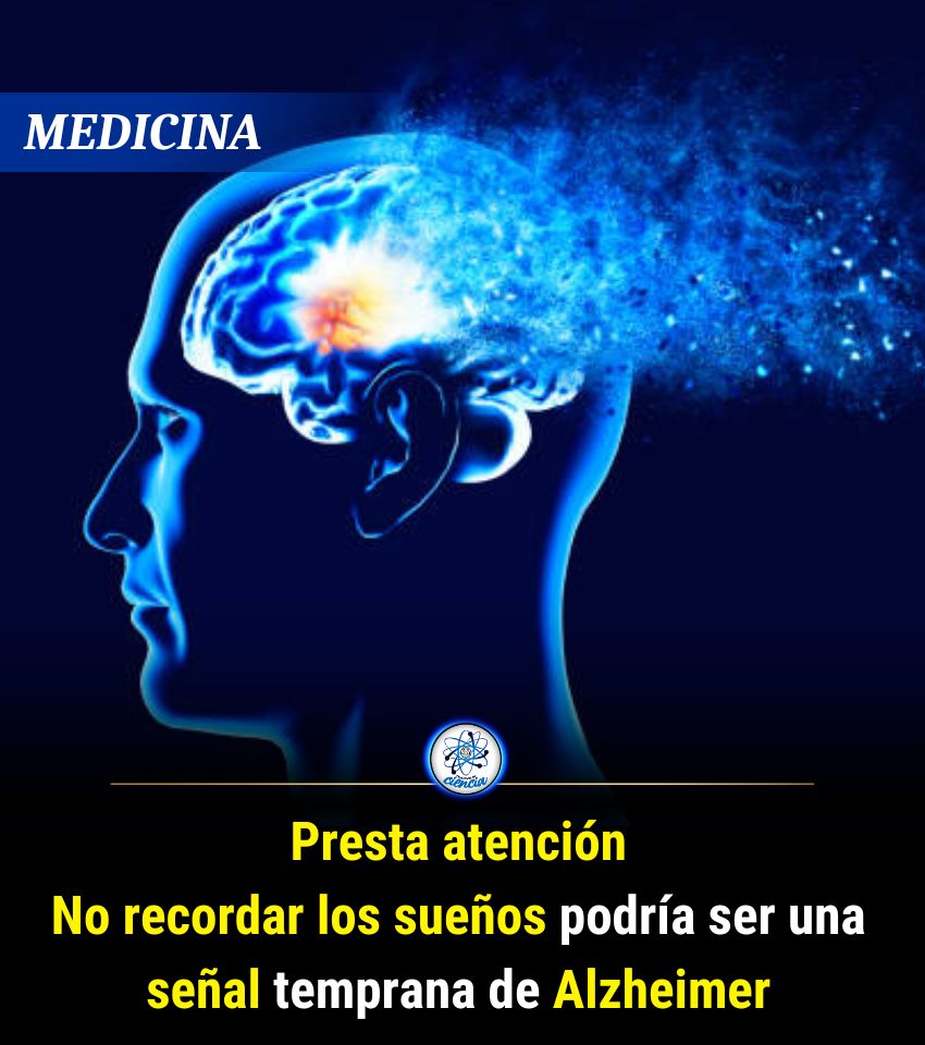 🚨Los científicos lo relacionaron con alteraciones en la denominada red neuronal por defecto. Que es un sistema cerebral implicado en la generación del contenido de los sueños y que se ve afectado en las fases iniciales del Alzheimer, de acuerdo con los investigadores.
