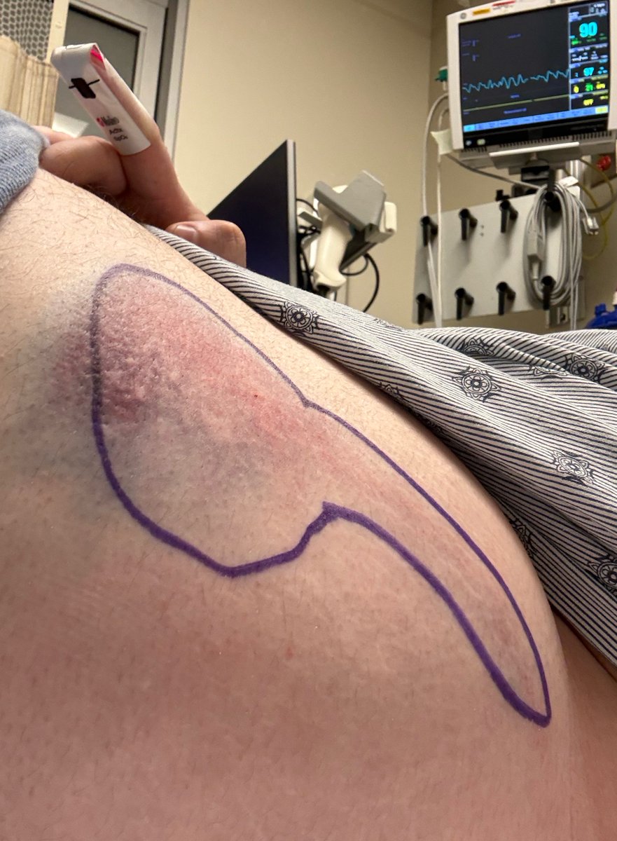 Jakob Ames tweet media