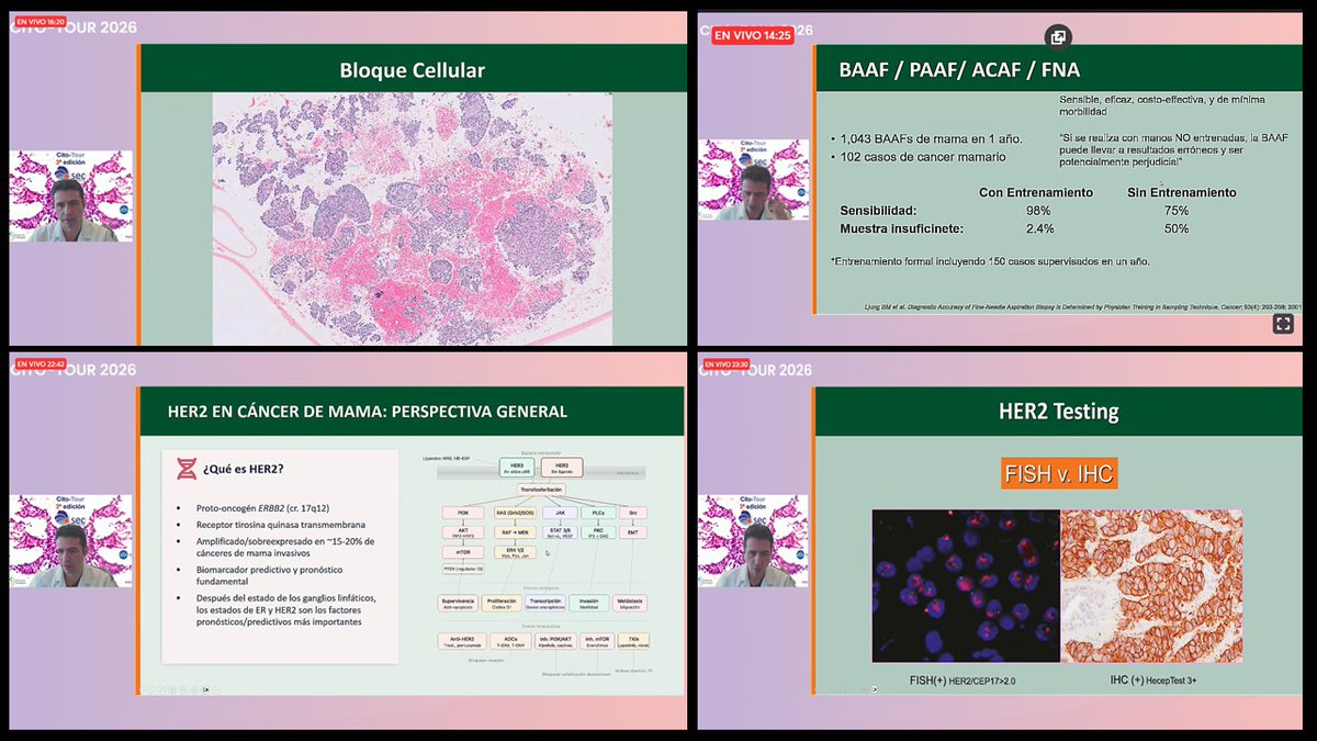 duckhuca's tweet image. ✅ #CitoTour2026.
👍🏽 Excelente ponencia del Dr Roberto Ruiz-Cordero @drruizcor.

#Cytology #CytoPath #PathX