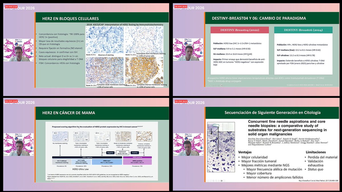 duckhuca's tweet image. ✅ #CitoTour2026.
👍🏽 Excelente ponencia del Dr Roberto Ruiz-Cordero @drruizcor.

#Cytology #CytoPath #PathX