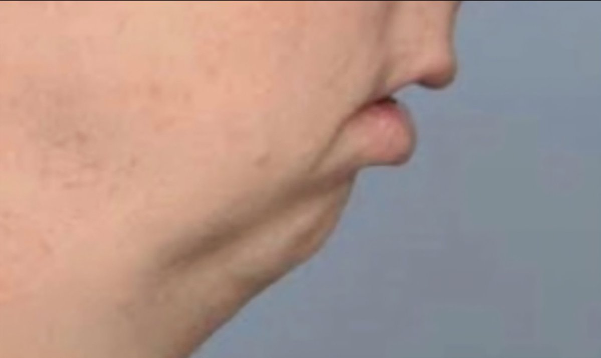 LMNOP+ (sheeee/it) tweet media