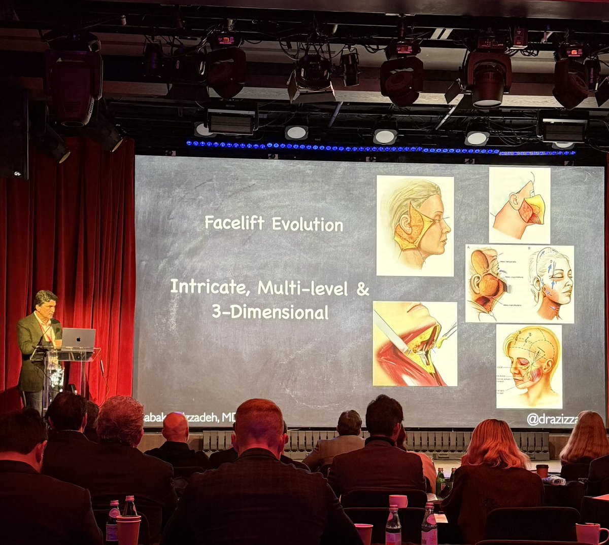 drazizzadeh's tweet photo. Just returned after presenting at the NYC Facelift & Rhinoplasty Master Course, where I presented on how to safely perform deep plane facelift to obtain natural results and prevent facial nerve issues. 

A detailed understanding of the anatomy—both in theory and in the lab—is essential to advancing surgical precision, safety, and gorgeous outcomes. Grateful to collaborate with an outstanding international faculty committed to elevating the field of facial plastic surgery through education and innovation.

Special thanks to Dr. Ramtin Kassir and Dr. Sheila Kassir for organizing.

#FacialPlasticSurgery #SurgicalEducation