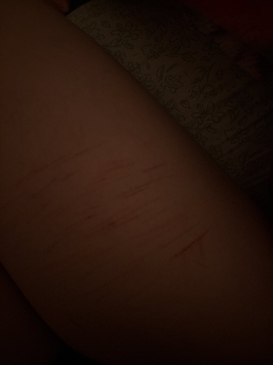 gh0ulkitten's tweet photo. 🩸#blood #cvts #SH #shtなりきりさんがrtしてくれてそれを見たshtなりきりさんがきっとフォローしてくれる https://t.co/9NuHBvPGkA