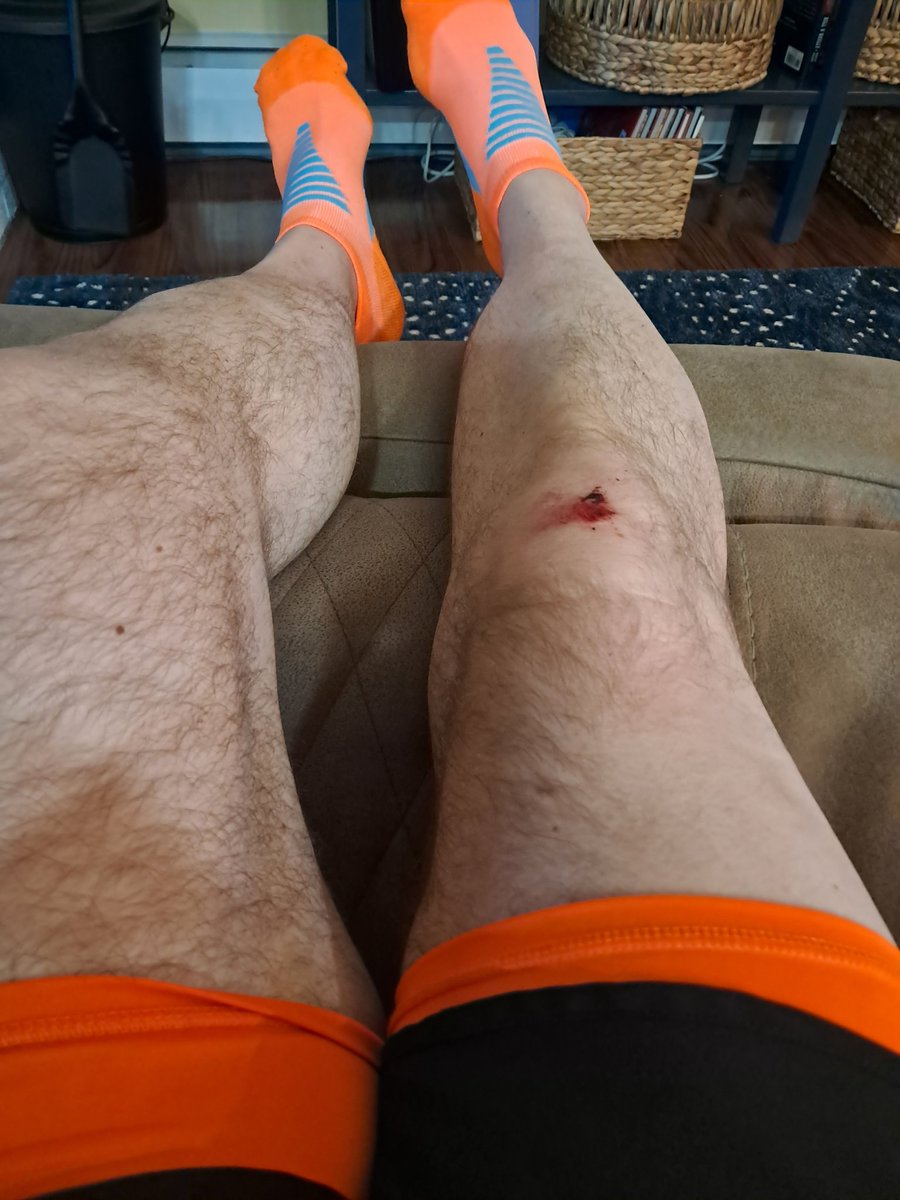 captainsal6's tweet photo. I got a oweee 😢
#IFallDown 🏃♂️ https://t.co/yhMcbNgN6d