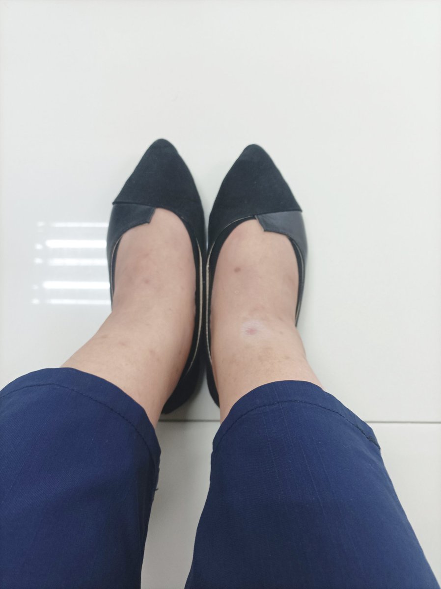 Di na maalis-alis yung pamamanas ko. Tapos nagkakaroon pa ako ng black dots.