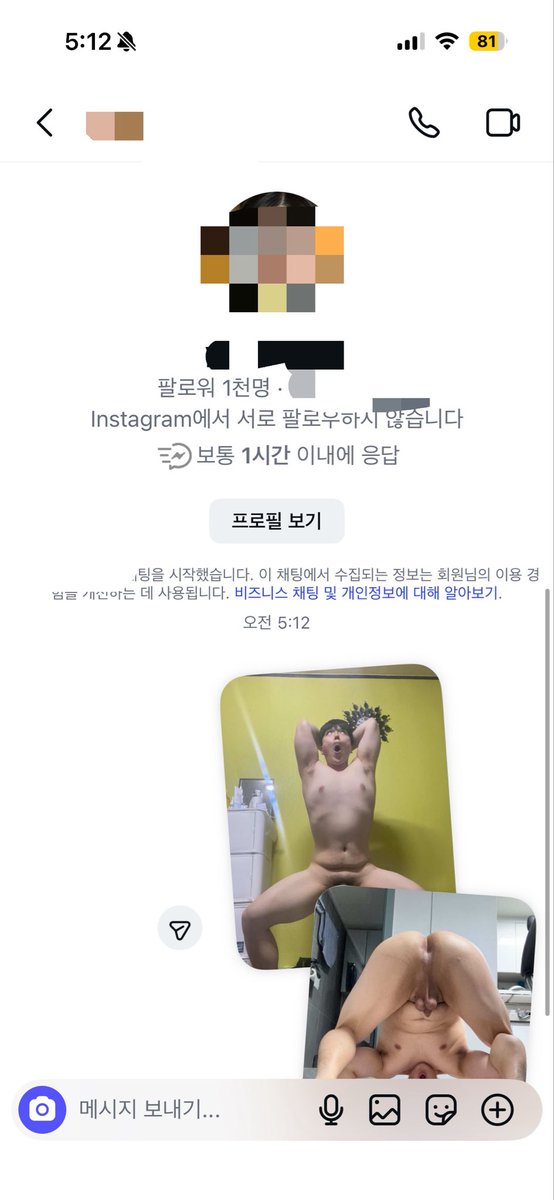 광대노예 tweet media