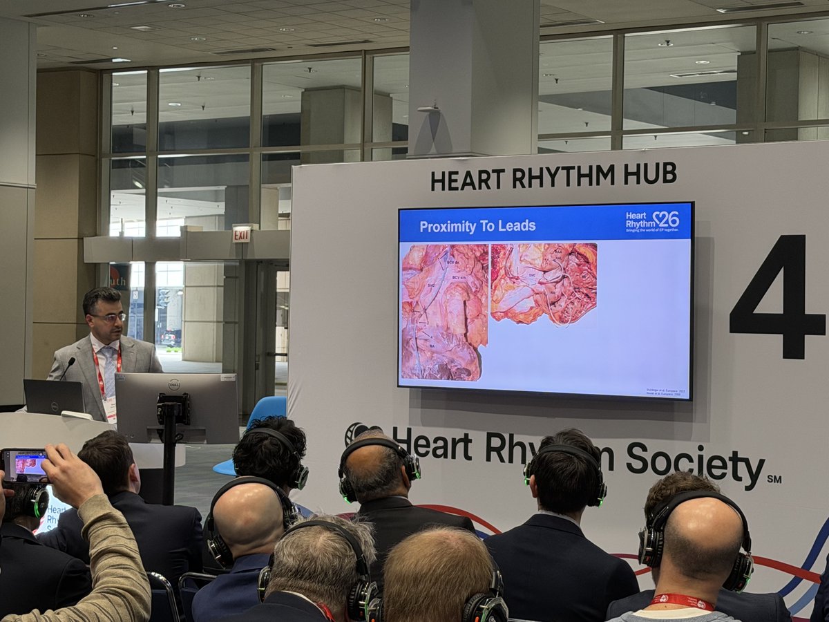 Rayan_ElZein's tweet photo. Honored to present our work at #HRS2026 from @OhioHealth Riverside Methodist Hospital on safety of PFA in patients with CIEDs under the leadership of Drs @AnishAminEP &amp; @badinmd. 

Thanks to @A_Robinson1107 &amp; RMH EP team!

Thanks Dr. @badinmd for incredible mentorship on project! https://t.co/BobhPqfogm