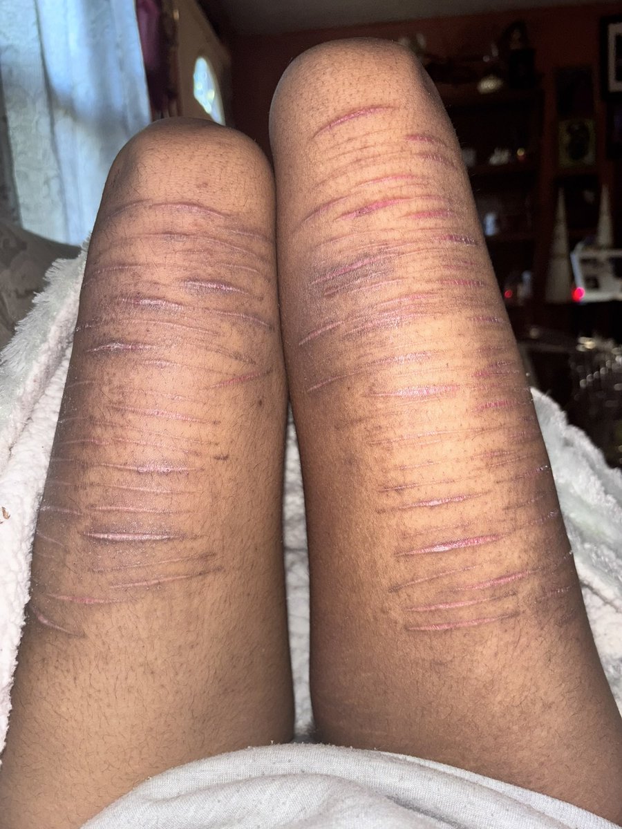 ˗ˏˋditzie ´ˎ˗ tweet media