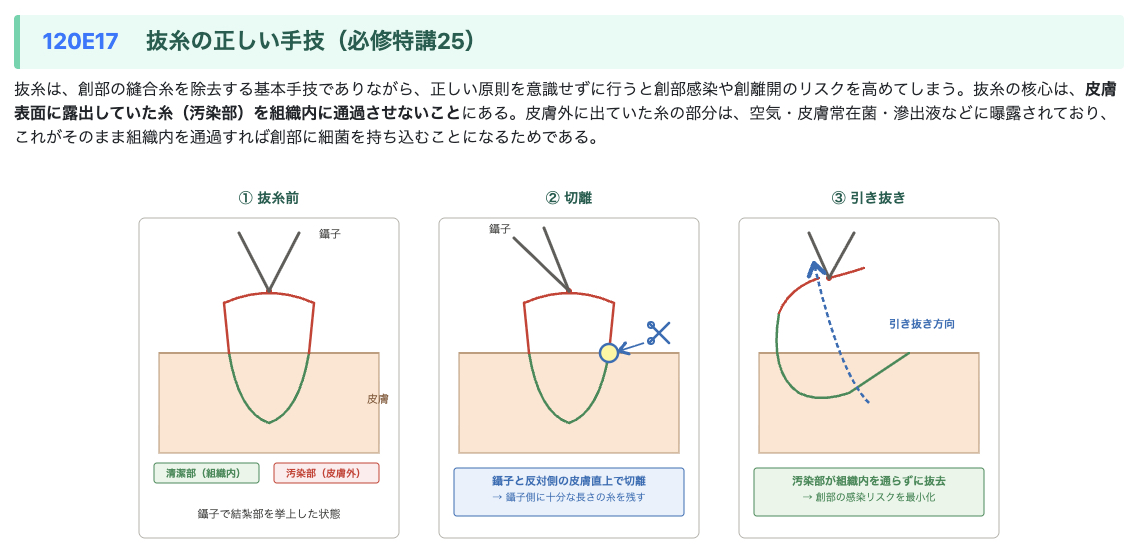 medu423's tweet photo. おはようございます！
120回Update、公開しました。
https://t.co/OWkXdar5ac
 
イラスト、表を豊富に盛り込み、120回の新出事項全29個をわかりやすくまとめました。
 
どなたでも無償でご利用いただけます。
かねてから目標としていた4月中のリリースに間に合ってほっとしています😇 https://t.co/MQlr7NvrBp