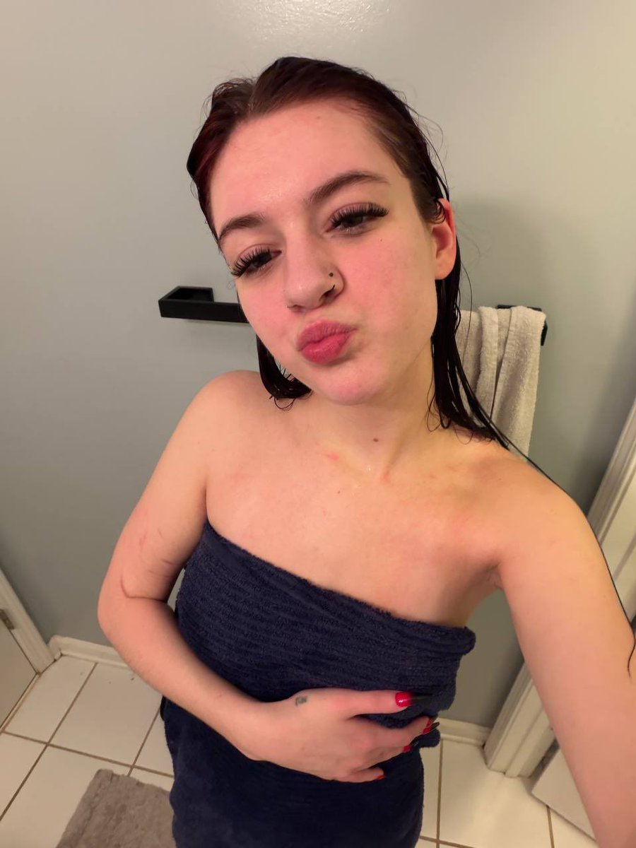 AlpineGirlie tweet media
