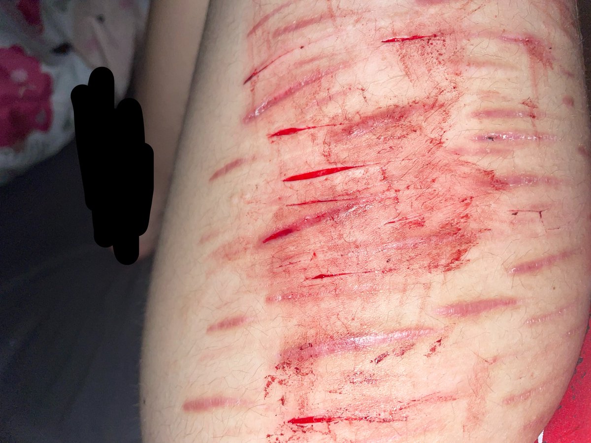 𝘺𝘶𝘮𝘦𝘮𝘪𝘻𝘶𝘬𝘪 𝘰𝘧 𝘴𝘩𝘦𝘥𝘵𝘸𝘵 ☁️🍬 tweet media