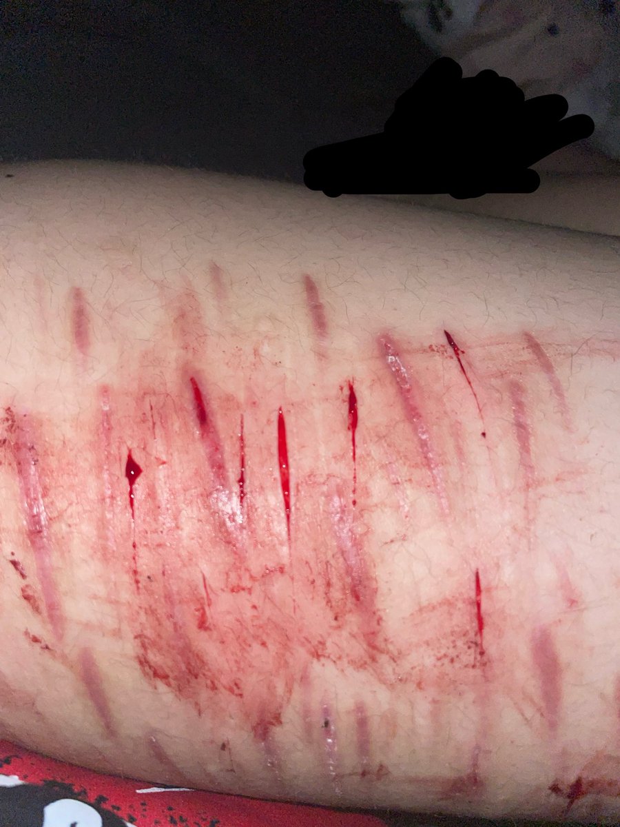 𝘺𝘶𝘮𝘦𝘮𝘪𝘻𝘶𝘬𝘪 𝘰𝘧 𝘴𝘩𝘦𝘥𝘵𝘸𝘵 ☁️🍬 tweet media