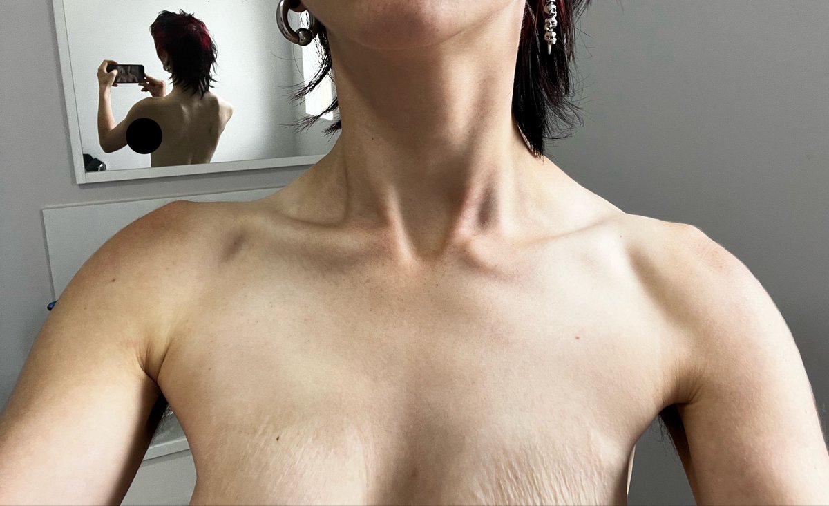 ꩜ fynnyard_bones ꩜ tweet media