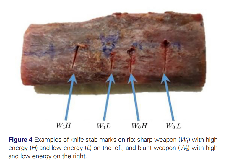 ForSciRes's tweet photo. FSR Vol 11, Issue 1 Research article 
A drop test device to study the variability of residual marks associated with stabbing attacks 
by Ignasi Galtés, Silvia García-Vilana and David Sánchez-Molina
https://t.co/ES8cdg5Vj1
#forensicscience #forensicanthropology #biomechanics #FSR https://t.co/h4YkgrCHBR