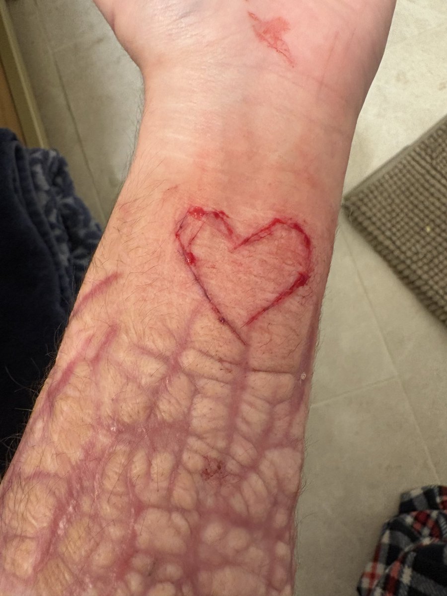 Kohane of sillytwt/ attempting recovery! tweet media