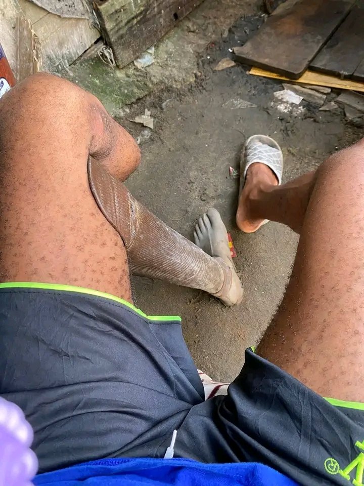 YEMI 🇬🇧 tweet media