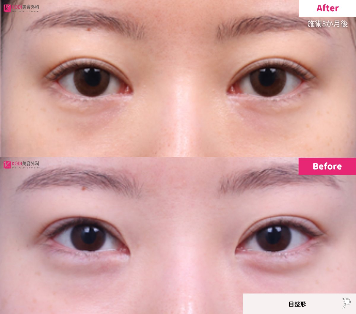 KODI美容外科💖江南でフィラーするならコディ💖 tweet media